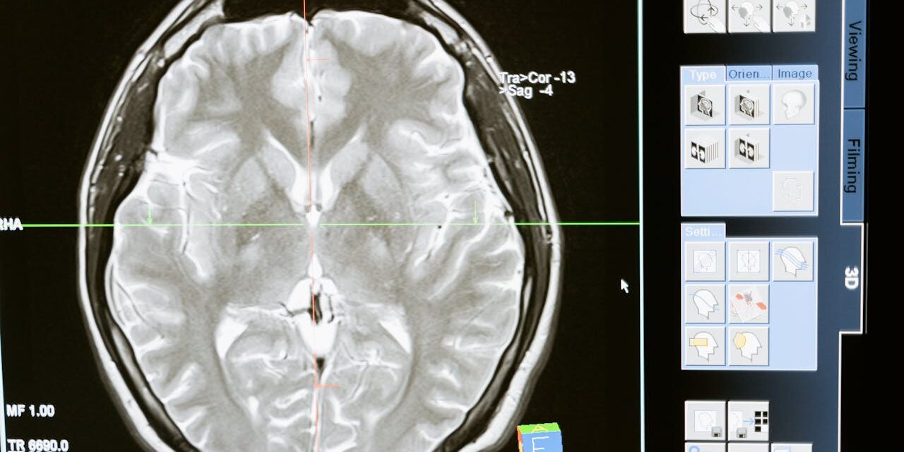 La actividad cerebral de las mujeres varía durante el ciclo menstrual por los cambios hormonales