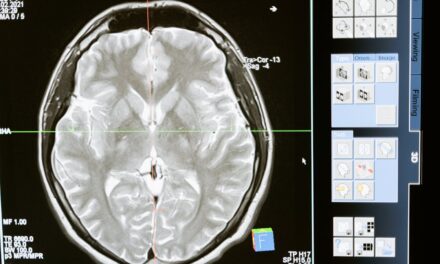 La actividad cerebral de las mujeres varía durante el ciclo menstrual por los cambios hormonales